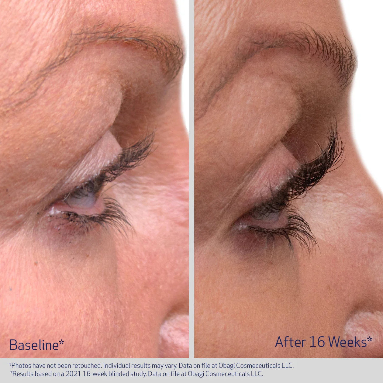 Obagi Nu-Cil Eyelash Enhancing Serum 3ml