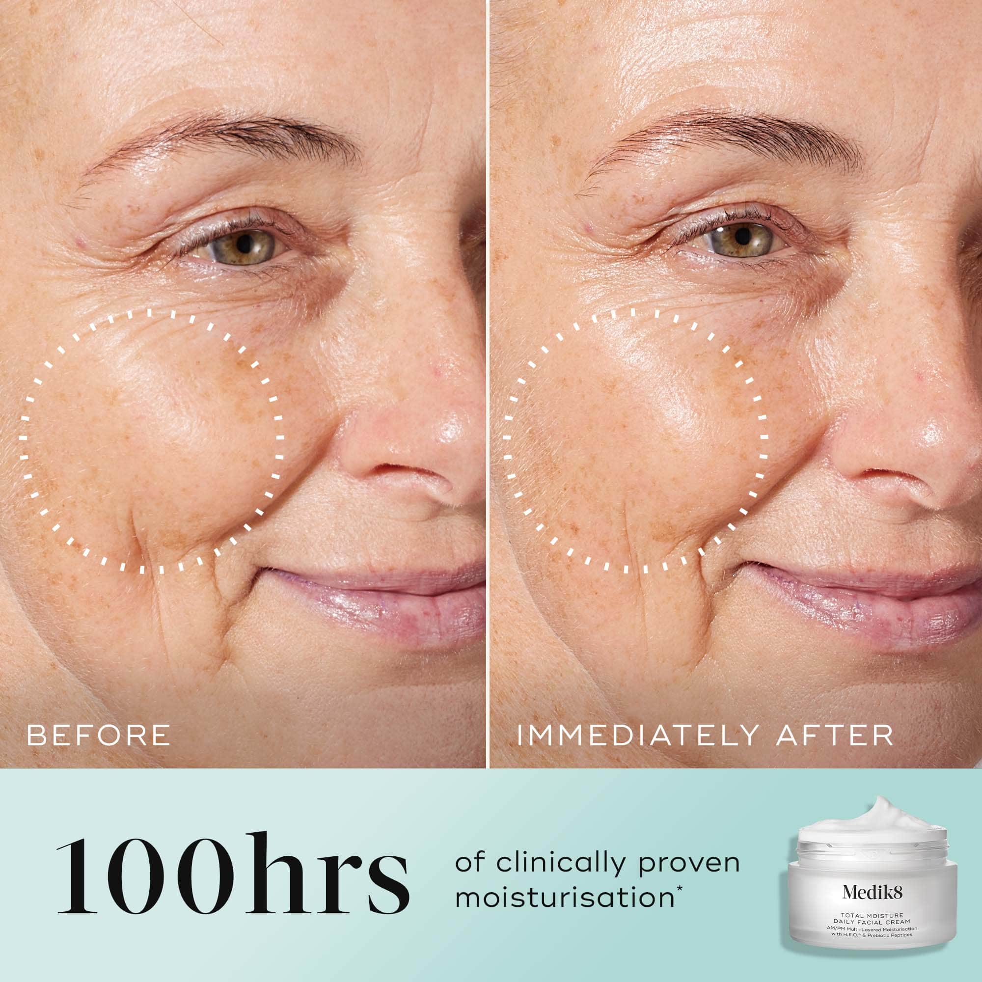 Medik8 Total Moisture Daily Facial Cream (50ml)