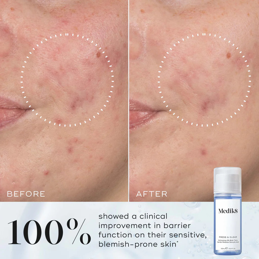 Medik8 Press & Clear Refill 150ml