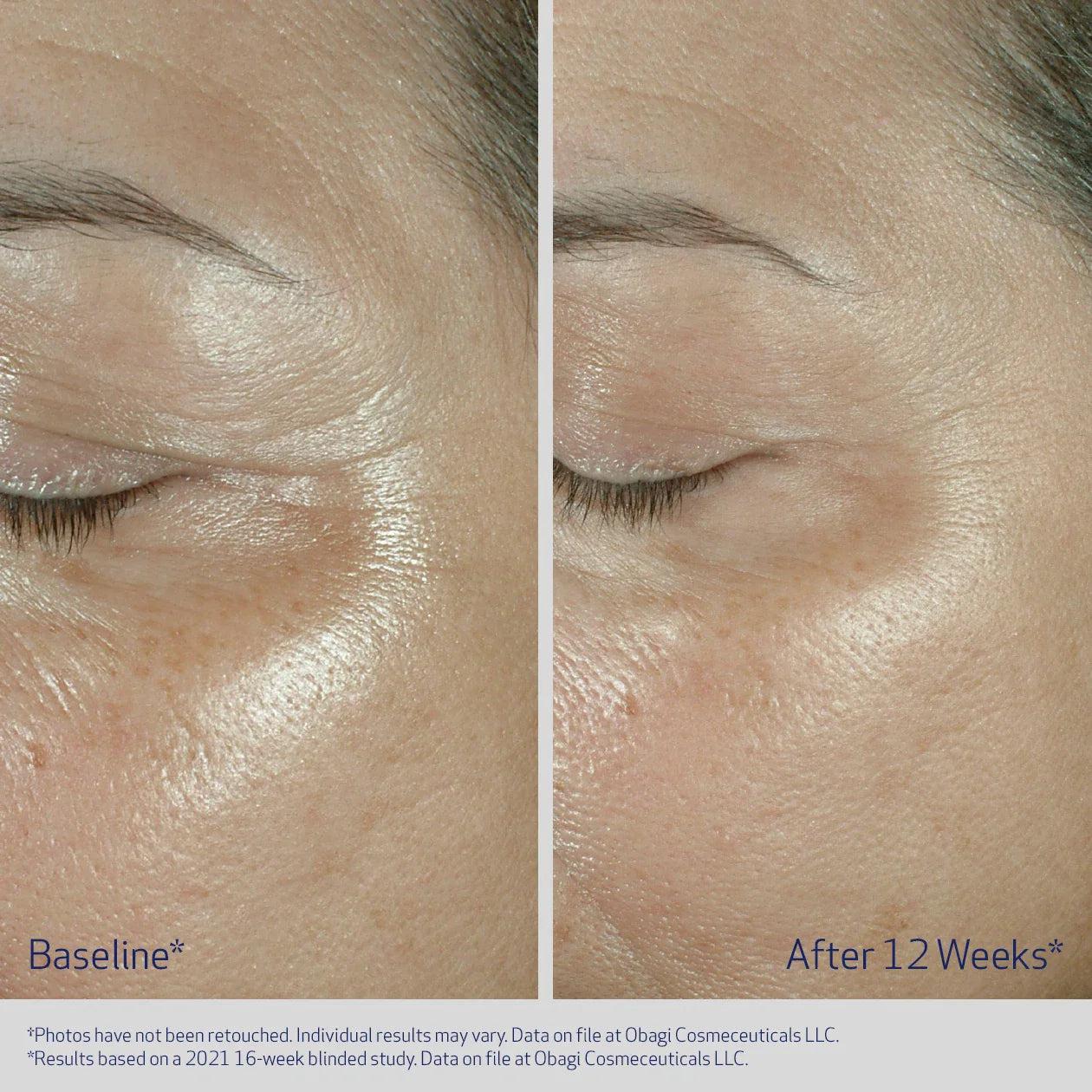 Obagi ELASTIderm Eye Cream 15g