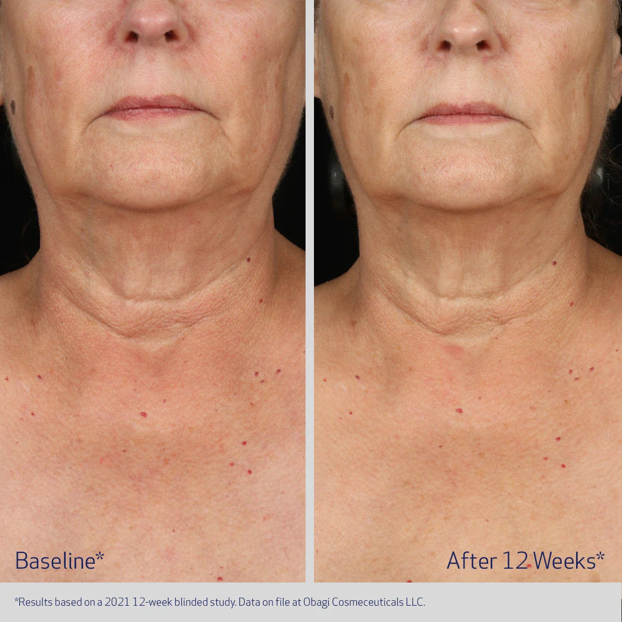 Obagi ELASTIderm Neck and Decollete Concentrate 60ml